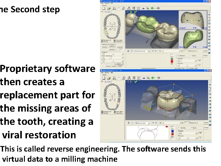 he Second step Proprietary software then creates a replacement part for the missing areas