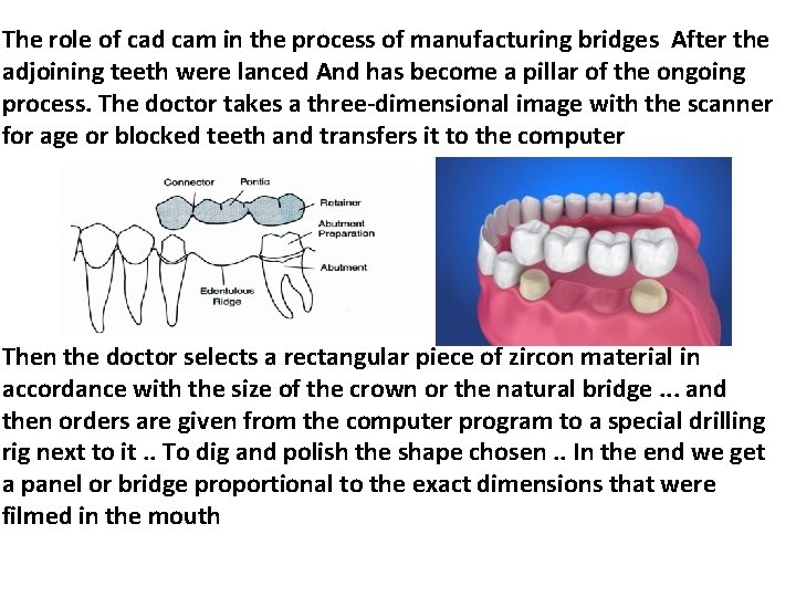 The role of cad cam in the process of manufacturing bridges After the adjoining