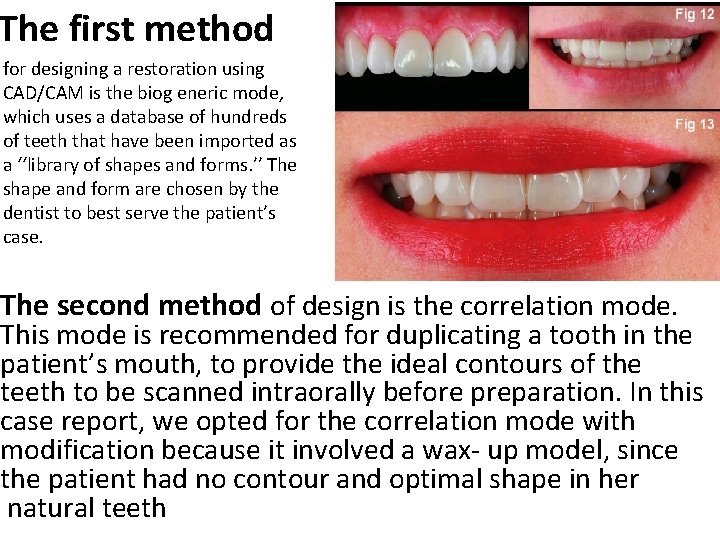 The first method for designing a restoration using CAD/CAM is the biog eneric mode,