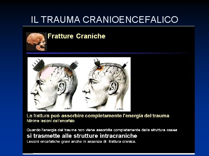 IL TRAUMA CRANIOENCEFALICO 