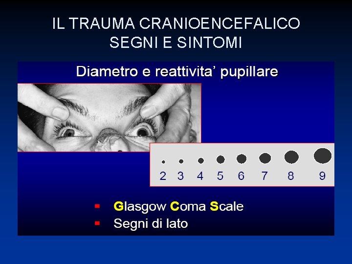 IL TRAUMA CRANIOENCEFALICO SEGNI E SINTOMI 