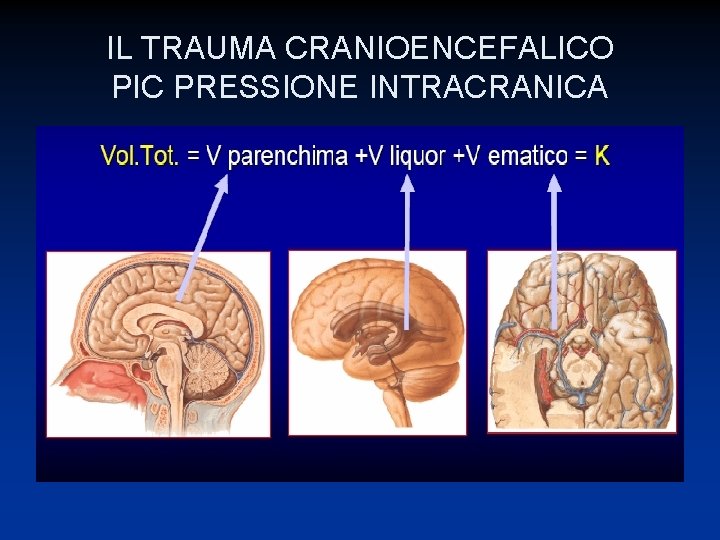 IL TRAUMA CRANIOENCEFALICO PIC PRESSIONE INTRACRANICA 