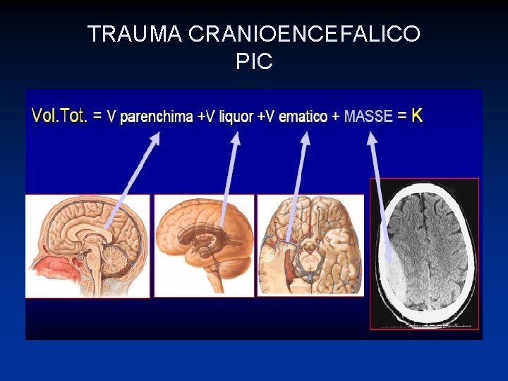 TRAUMA CRANIOENCEFALICO PIC 