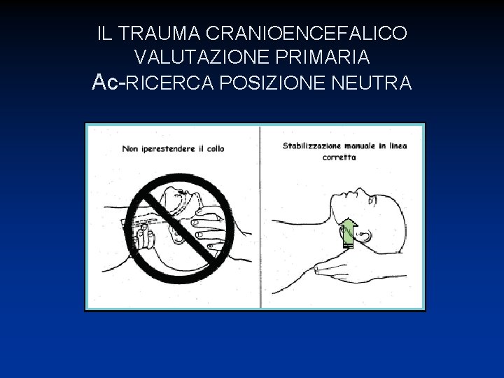 IL TRAUMA CRANIOENCEFALICO VALUTAZIONE PRIMARIA Ac-RICERCA POSIZIONE NEUTRA 