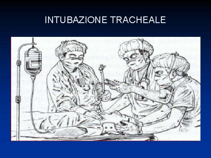 INTUBAZIONE TRACHEALE 