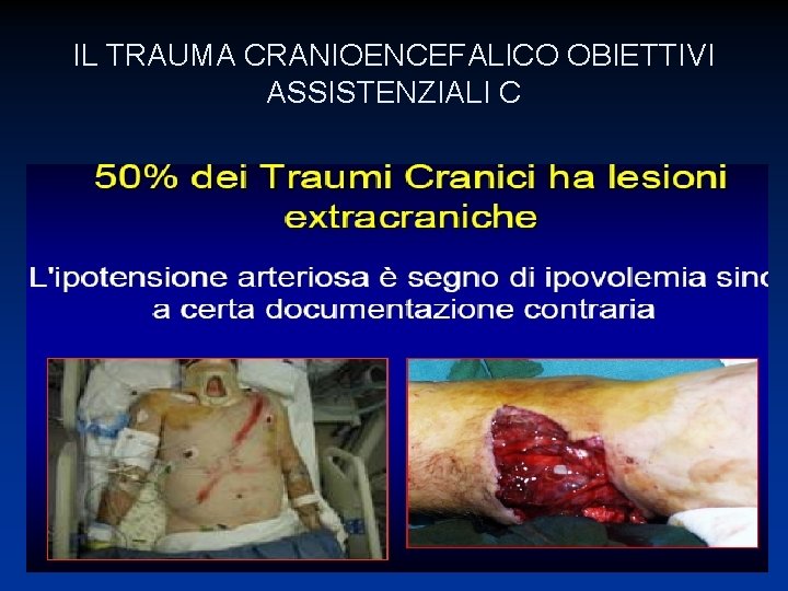 IL TRAUMA CRANIOENCEFALICO OBIETTIVI ASSISTENZIALI C 