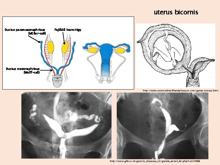 uterus bicornis Ductus paramesonephricus (Müller-cső) Fejlődő ivarmirigy Ductus mesonephricus (Wolff-cső) http: //www. womenshealthandpleasure. com/gynae/uterus.