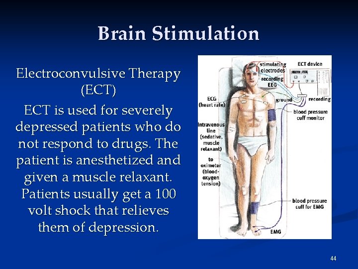 Brain Stimulation Electroconvulsive Therapy (ECT) ECT is used for severely depressed patients who do