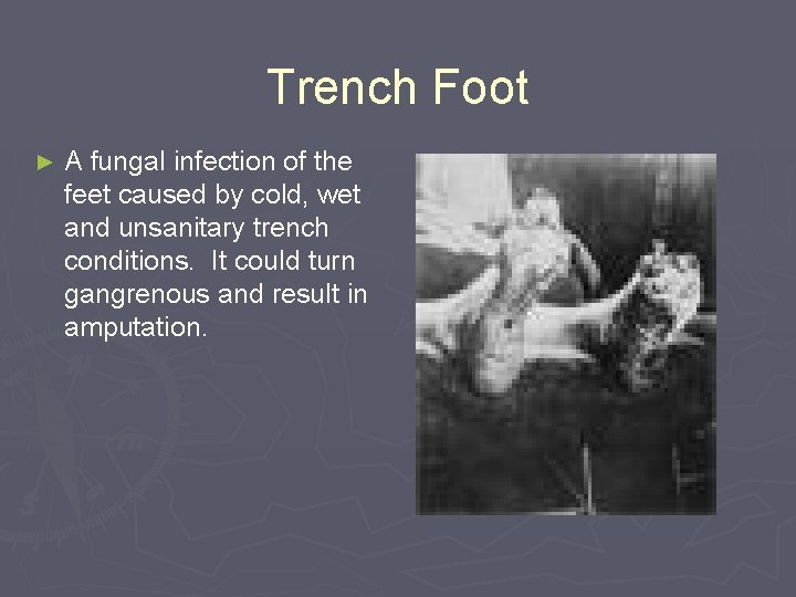 Trench Foot ► A fungal infection of the feet caused by cold, wet and