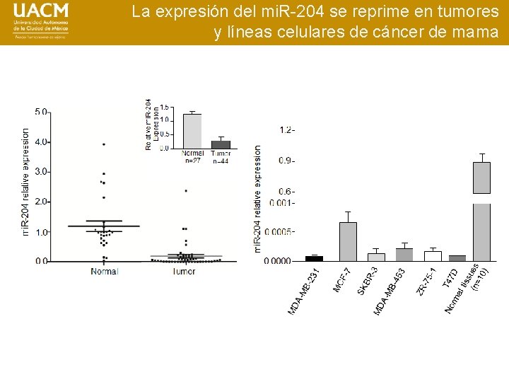 La expresión del mi. R-204 se reprime en tumores y líneas celulares de cáncer