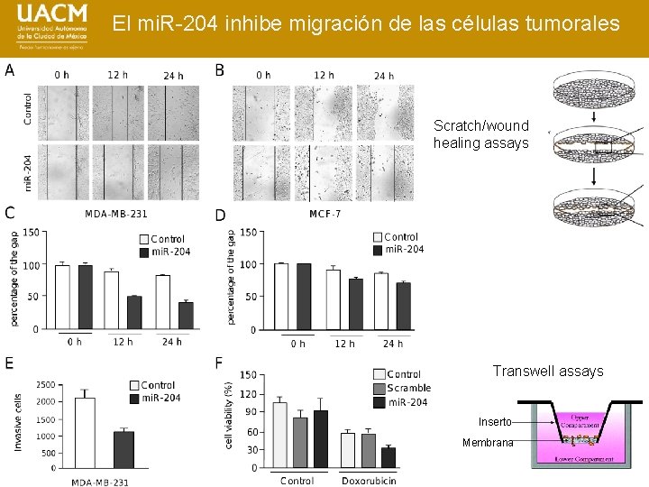 El mi. R-204 inhibe migración de las células tumorales Scratch/wound healing assays Transwell assays