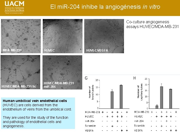 El mi. R-204 inhibe la angiogénesis in vitro Co-culture angiogenesis assays HUVEC/MDA-MB-231 -Sc HUVEC/MDA-MB-231