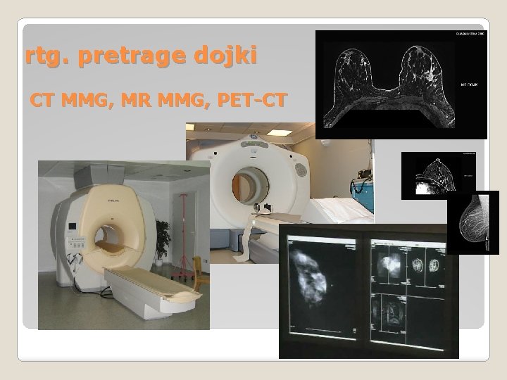 rtg. pretrage dojki CT MMG, MR MMG, PET-CT rtg. pretrage dojki CT MMG, MR MMG, PET-CT