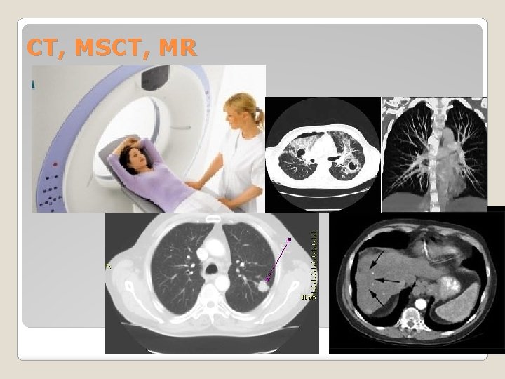 CT, MSCT, MR CT, MSCT, MR