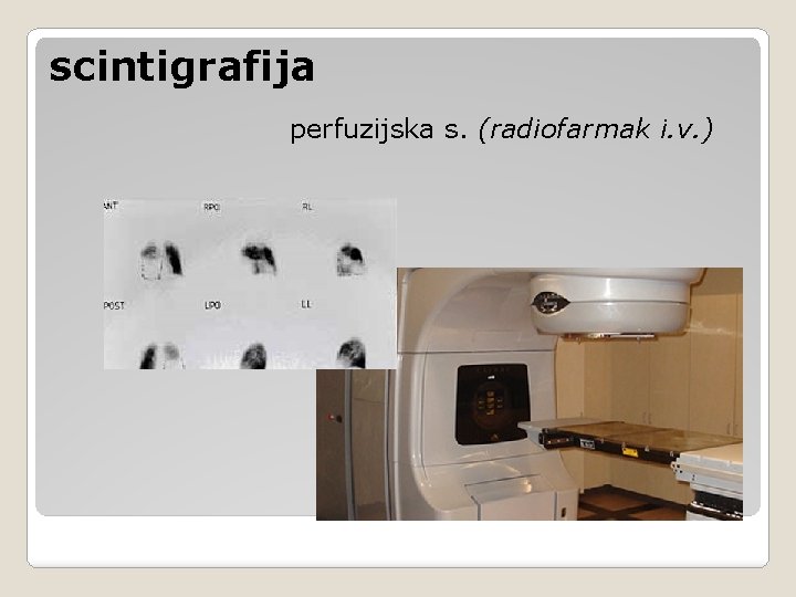 scintigrafija perfuzijska s. (radiofarmak i. v. ) scintigrafija perfuzijska s. (radiofarmak i. v. )