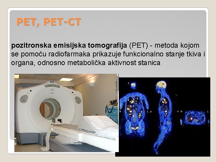PET, PET-CT pozitronska emisijska tomografija (PET) - metoda kojom se pomoću radiofarmaka prikazuje funkcionalno PET, PET-CT pozitronska emisijska tomografija (PET) - metoda kojom se pomoću radiofarmaka prikazuje funkcionalno