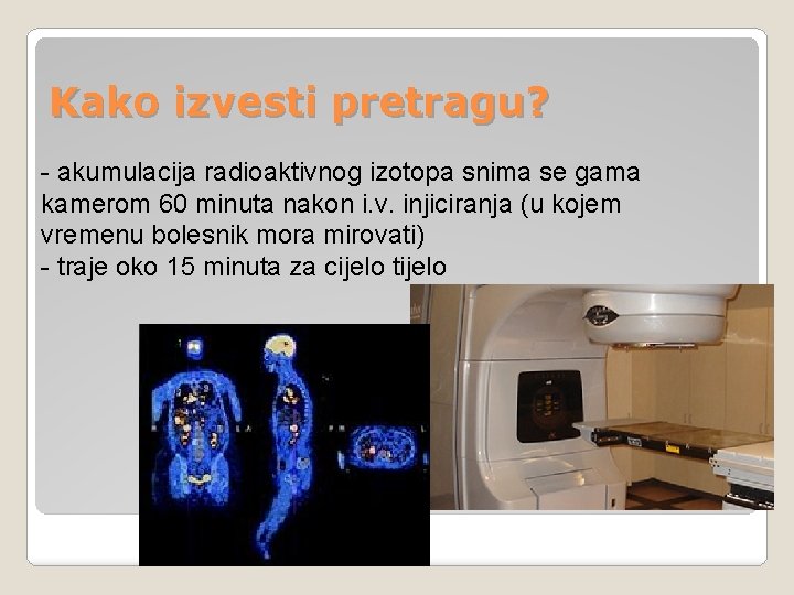 Kako izvesti pretragu? - akumulacija radioaktivnog izotopa snima se gama kamerom 60 minuta nakon Kako izvesti pretragu? - akumulacija radioaktivnog izotopa snima se gama kamerom 60 minuta nakon