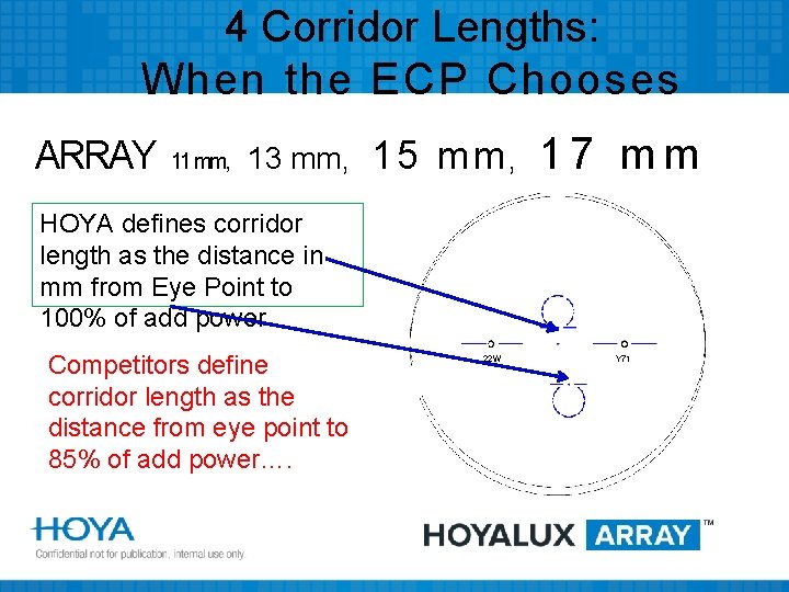 4 Corridor Lengths: When the ECP Chooses ARRAY 11 mm, 13 mm, 15 mm