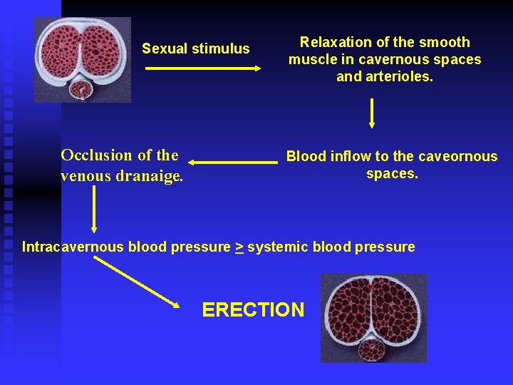 Sexual stimulus Occlusion of the venous dranaige. Relaxation of the smooth muscle in cavernous