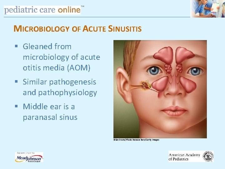 TM MICROBIOLOGY OF ACUTE SINUSITIS § Gleaned from microbiology of acute otitis media (AOM)