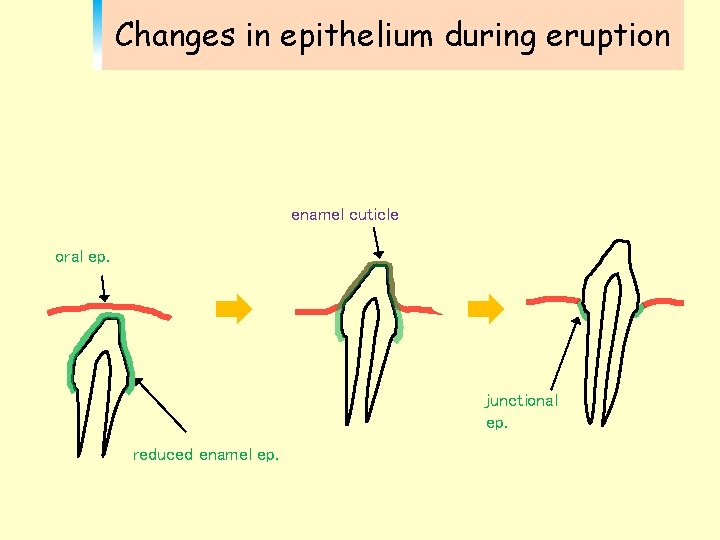 Changes in epithelium during eruption enamel cuticle oral ep. junctional ep. reduced enamel ep.