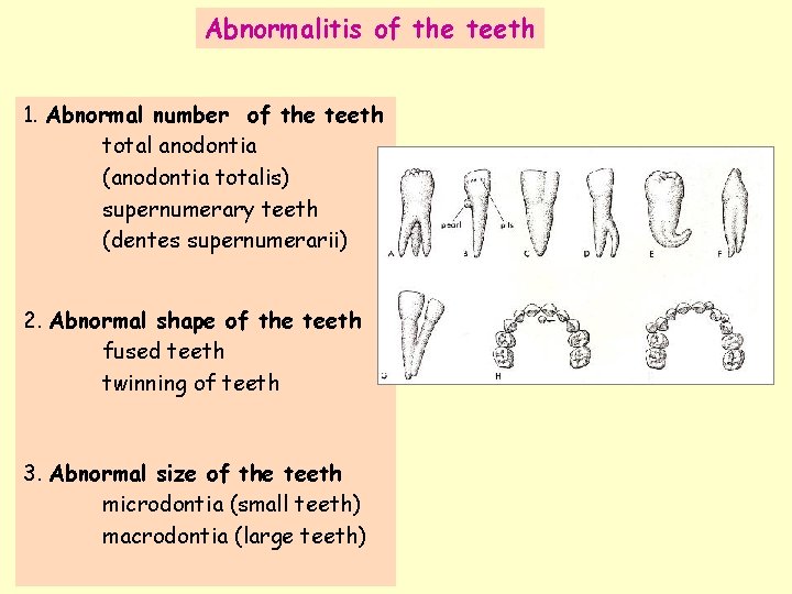 Abnormalitis of the teeth 1. Abnormal number of the teeth total anodontia (anodontia totalis)