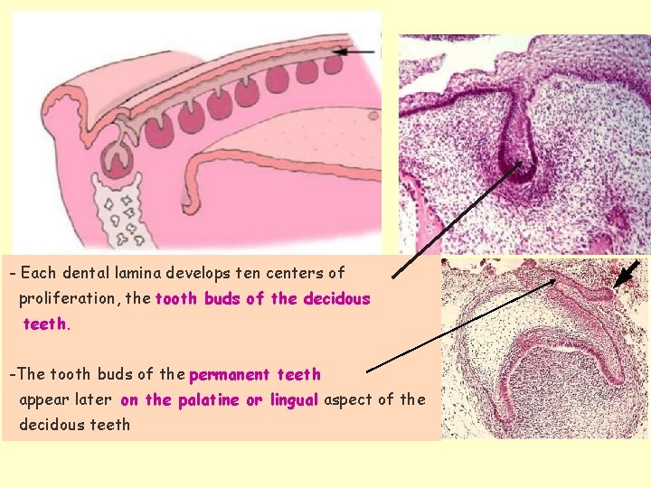 Dental lamina - Each dental lamina develops ten centers of proliferation, the tooth buds