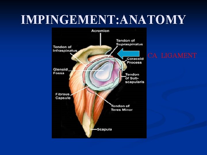 IMPINGEMENT: ANATOMY CA LIGAMENT 