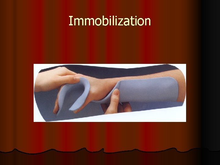 Immobilization 