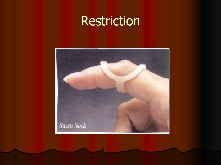 Restriction 