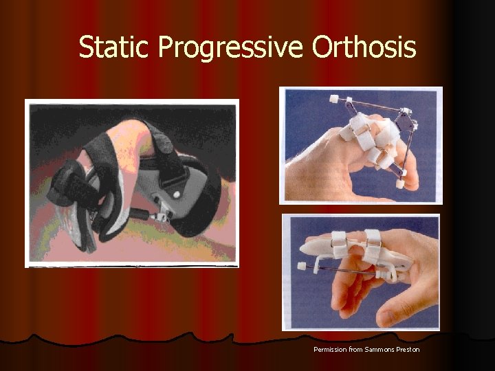 Static Progressive Orthosis Permission from Sammons Preston 