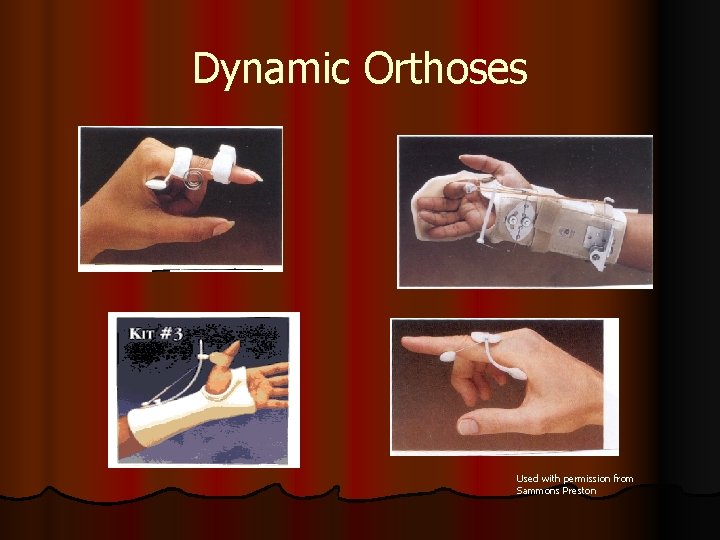 Dynamic Orthoses Used with permission from Sammons Preston 