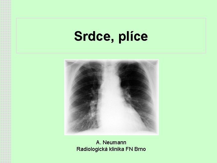 Srdce, plíce A. Neumann Radiologická klinika FN Brno 