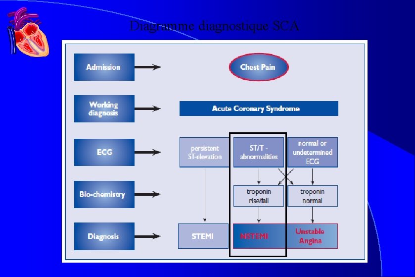 Diagramme diagnostique SCA Diagramme diagnostique SCA