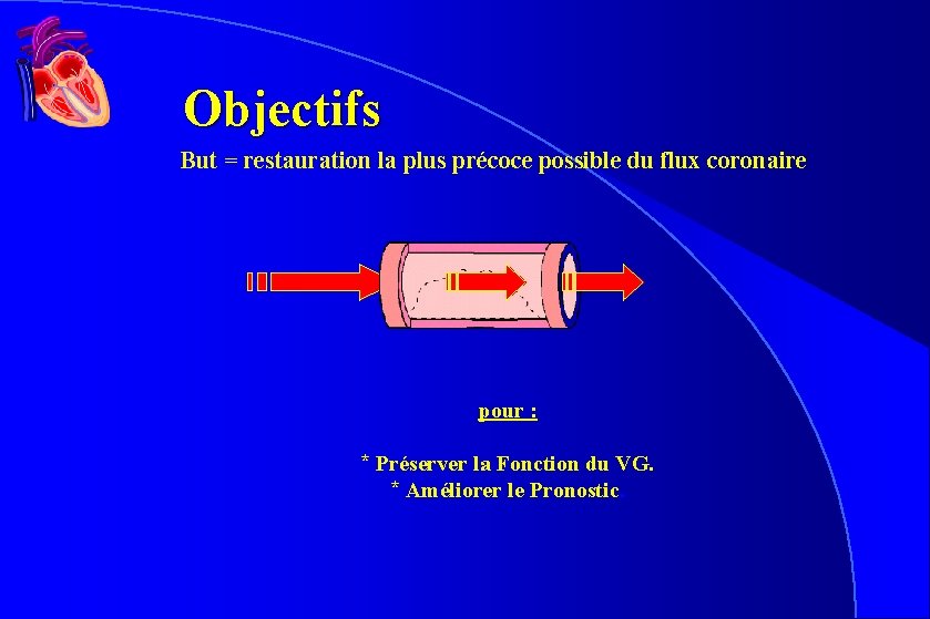 Objectifs But = restauration la plus précoce possible du flux coronaire pour : * Objectifs But = restauration la plus précoce possible du flux coronaire pour : *