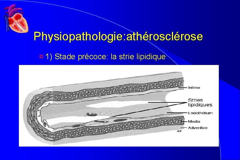 Physiopathologie: athérosclérose ¤ 1) Stade précoce: la strie lipidique Physiopathologie: athérosclérose ¤ 1) Stade précoce: la strie lipidique