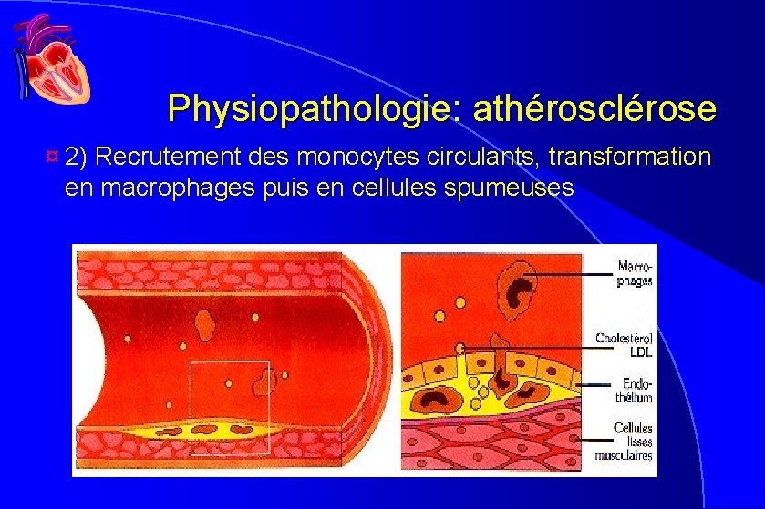Physiopathologie: athérosclérose ¤ 2) Recrutement des monocytes circulants, transformation en macrophages puis en cellules Physiopathologie: athérosclérose ¤ 2) Recrutement des monocytes circulants, transformation en macrophages puis en cellules