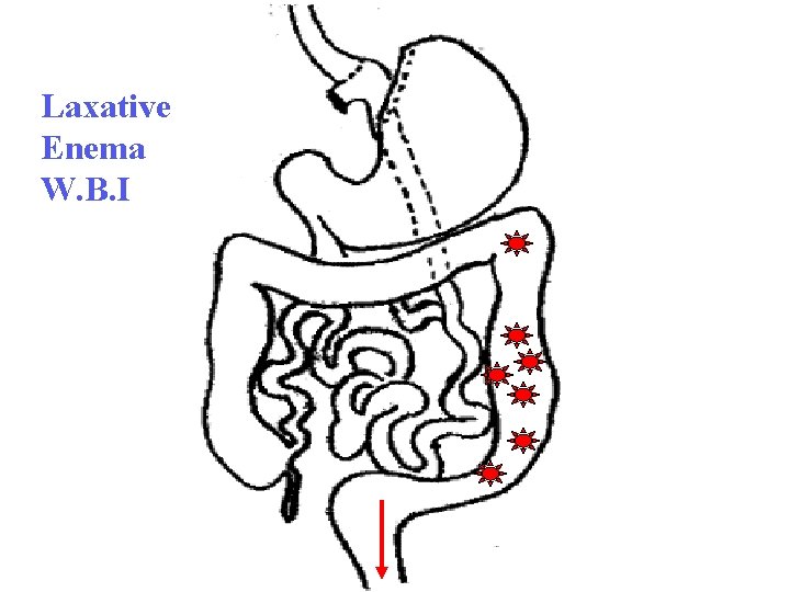 Laxative Enema W. B. I 