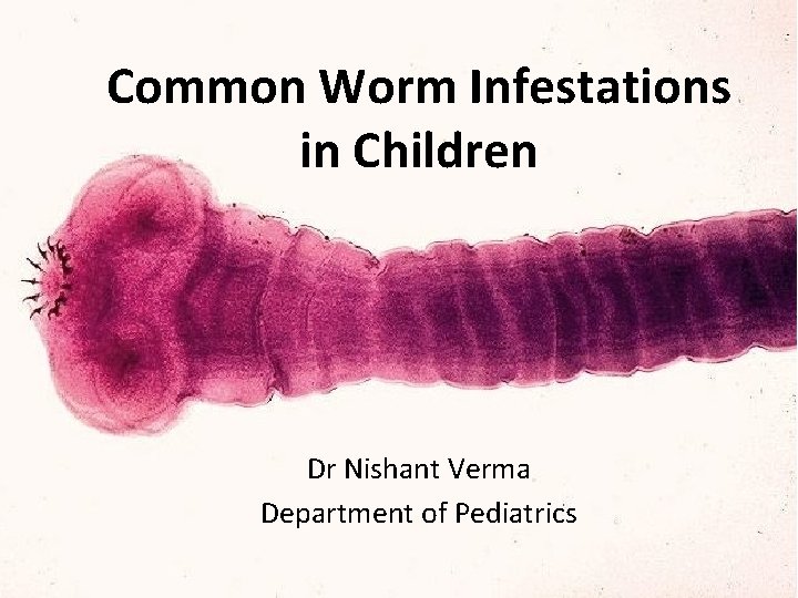 Common Worm Infestations in Children Dr Nishant Verma Department of Pediatrics Common Worm Infestations in Children Dr Nishant Verma Department of Pediatrics