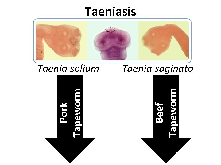 Taeniasis Taenia saginata Beef Tapeworm Pork Tapeworm Taenia solium Taeniasis Taenia saginata Beef Tapeworm Pork Tapeworm Taenia solium