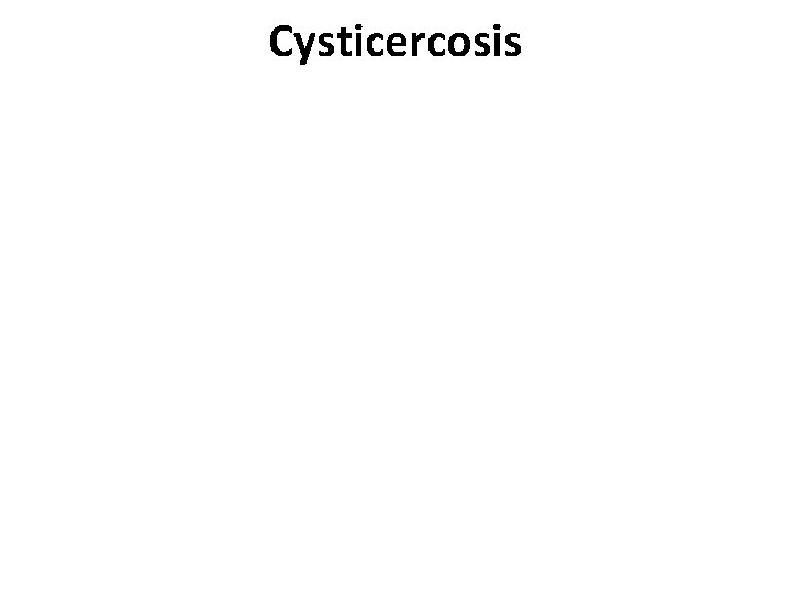 Cysticercosis Cysticercosis