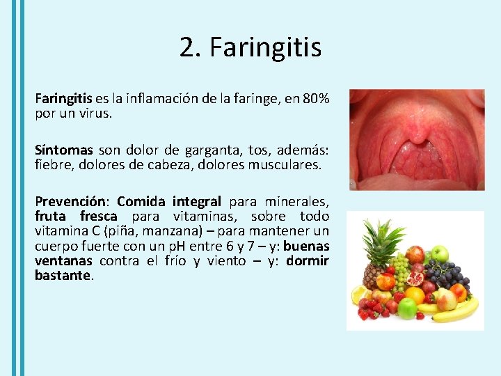 2. Faringitis es la inflamación de la faringe, en 80% por un virus. Síntomas