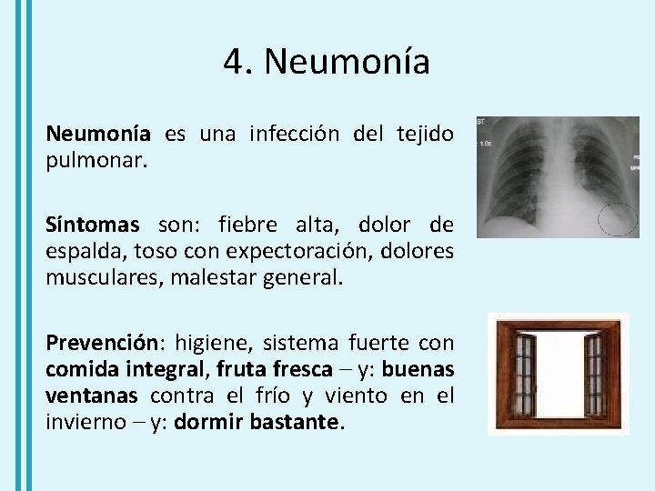 4. Neumonía es una infección del tejido pulmonar. Síntomas son: fiebre alta, dolor de
