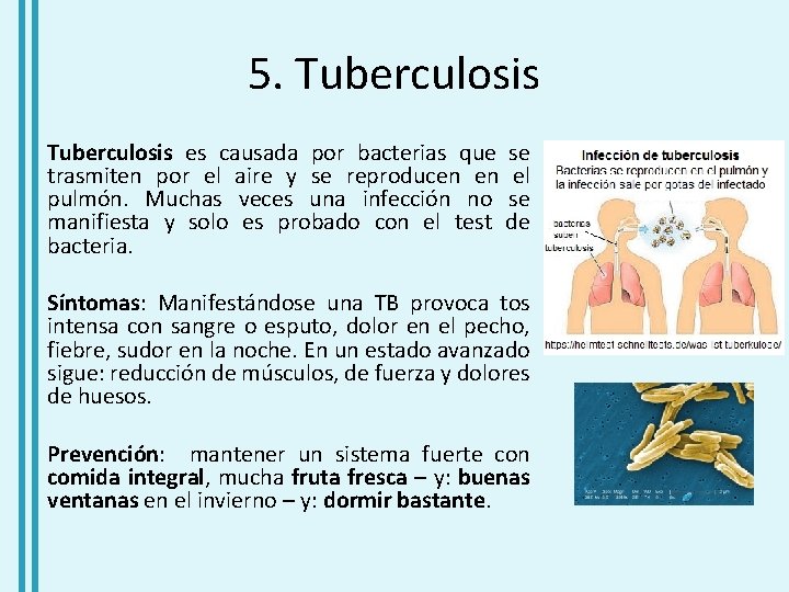 5. Tuberculosis es causada por bacterias que se trasmiten por el aire y se