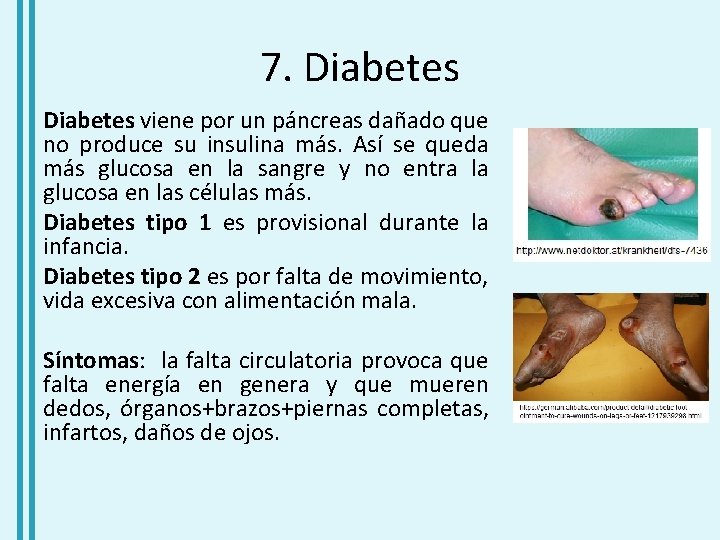 7. Diabetes viene por un páncreas dañado que no produce su insulina más. Así