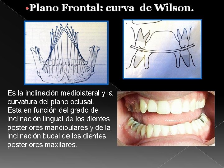  • Plano Frontal: curva de Wilson. Es la inclinación mediolateral y la curvatura