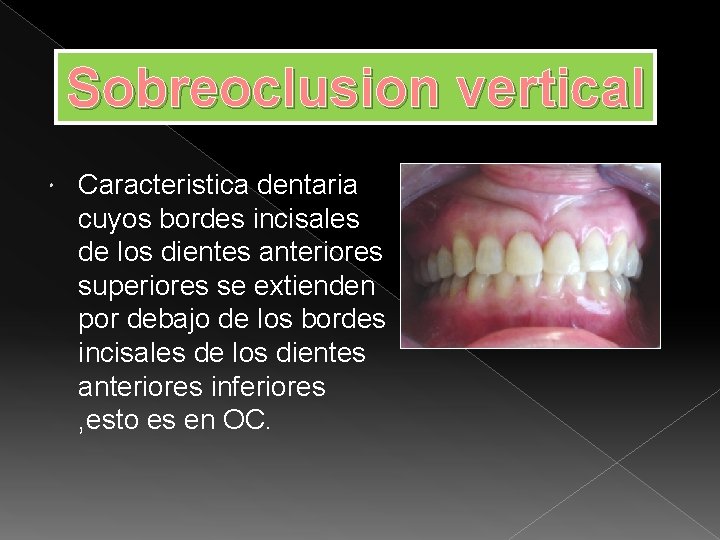 Sobreoclusion vertical Caracteristica dentaria cuyos bordes incisales de los dientes anteriores superiores se extienden