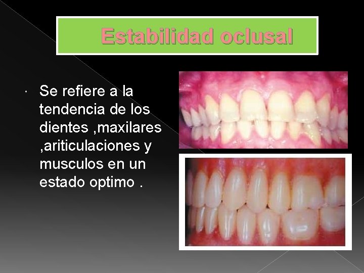 Estabilidad oclusal Se refiere a la tendencia de los dientes , maxilares , ariticulaciones