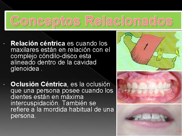 Conceptos Relacionados Relación céntrica es cuando los maxilares están en relación con el complejo