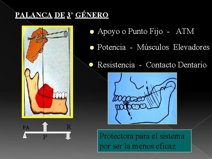 PALANCA DE 3º GÉNERO Apoyo o Punto Fijo - ATM Potencia - Músculos Elevadores